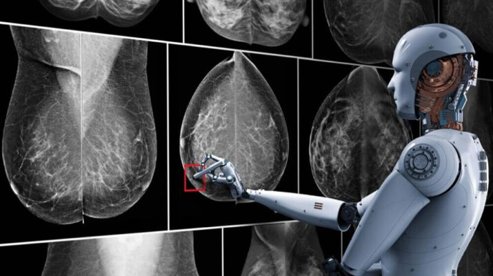 Google DeepMind Klaim AI Baru Bisa Bantu Diagnosa Kanker